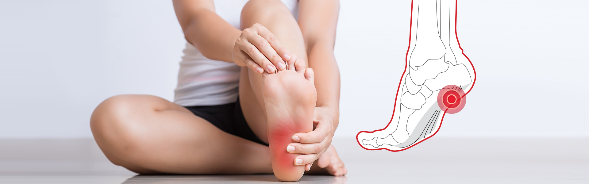 Everything You Need to Know About Plantar Fasciitis